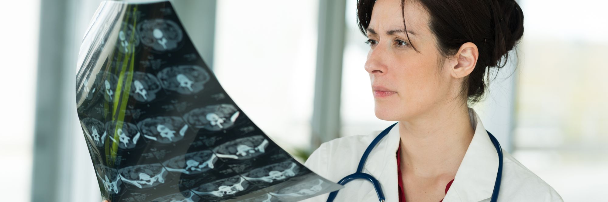 [Ekstra] Studie: Derfor bør du være skeptisk til å bruke Chat GPT som lege